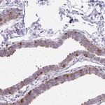 CARD9 Antibody in Immunohistochemistry (Paraffin) (IHC (P))