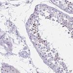 CARD9 Antibody in Immunohistochemistry (Paraffin) (IHC (P))