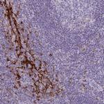 CARD9 Antibody in Immunohistochemistry (Paraffin) (IHC (P))