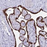 PRDM9 Antibody in Immunohistochemistry (Paraffin) (IHC (P))