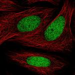 ZNF182 Antibody in Immunocytochemistry (ICC/IF)