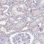 ZNF182 Antibody in Immunohistochemistry (Paraffin) (IHC (P))