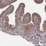 MYO19 Antibody in Immunohistochemistry (Paraffin) (IHC (P))