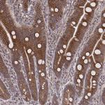 MYO19 Antibody in Immunohistochemistry (Paraffin) (IHC (P))