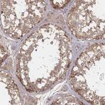 MYO19 Antibody in Immunohistochemistry (Paraffin) (IHC (P))