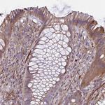 IFIT3 Antibody in Immunohistochemistry (Paraffin) (IHC (P))