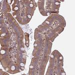 IFIT3 Antibody in Immunohistochemistry (Paraffin) (IHC (P))