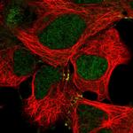 MAP2K4 Antibody in Immunocytochemistry (ICC/IF)