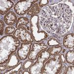 ACOT2 Antibody in Immunohistochemistry (Paraffin) (IHC (P))