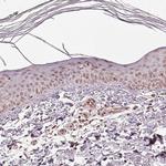 ACOT2 Antibody in Immunohistochemistry (Paraffin) (IHC (P))