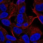 MYT1L Antibody in Immunocytochemistry (ICC/IF)