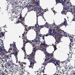 FAM101B Antibody in Immunohistochemistry (Paraffin) (IHC (P))