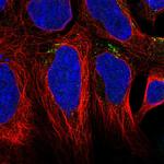 AGPAT4 Antibody in Immunocytochemistry (ICC/IF)