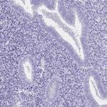 CD21 Antibody in Immunohistochemistry (Paraffin) (IHC (P))