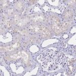 CD21 Antibody in Immunohistochemistry (Paraffin) (IHC (P))