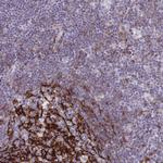 CD21 Antibody in Immunohistochemistry (Paraffin) (IHC (P))