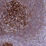 CD21 Antibody in Immunohistochemistry (Paraffin) (IHC (P))