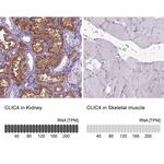 CLIC4 Antibody