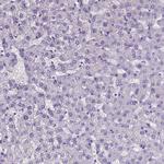 CLIC4 Antibody in Immunohistochemistry (Paraffin) (IHC (P))