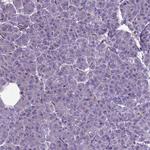 CLIC4 Antibody in Immunohistochemistry (Paraffin) (IHC (P))