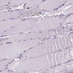 CLIC4 Antibody in Immunohistochemistry (Paraffin) (IHC (P))