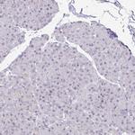 EED Antibody in Immunohistochemistry (Paraffin) (IHC (P))