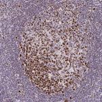 EED Antibody in Immunohistochemistry (Paraffin) (IHC (P))