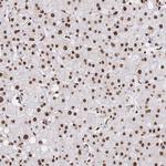 SRSF1 Antibody in Immunohistochemistry (Paraffin) (IHC (P))