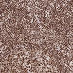 SRSF1 Antibody in Immunohistochemistry (Paraffin) (IHC (P))