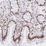 SRSF1 Antibody in Immunohistochemistry (Paraffin) (IHC (P))