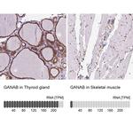 GANAB Antibody