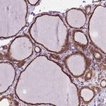 GANAB Antibody in Immunohistochemistry (Paraffin) (IHC (P))