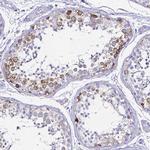 Cyclin B1 Antibody in Immunohistochemistry (Paraffin) (IHC (P))