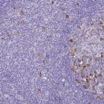 Cyclin B1 Antibody in Immunohistochemistry (Paraffin) (IHC (P))