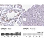 Cyclin B1 Antibody