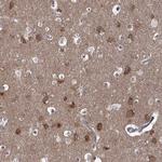 TRBP Antibody in Immunohistochemistry (Paraffin) (IHC (P))