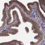 ALS2CR1 Antibody in Immunohistochemistry (Paraffin) (IHC (P))