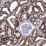 MCCC2 Antibody in Immunohistochemistry (Paraffin) (IHC (P))