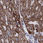 MCCC2 Antibody in Immunohistochemistry (Paraffin) (IHC (P))