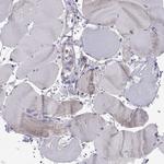 MCCC2 Antibody in Immunohistochemistry (Paraffin) (IHC (P))