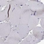 MCCC2 Antibody in Immunohistochemistry (Paraffin) (IHC (P))