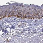 MCCC2 Antibody in Immunohistochemistry (Paraffin) (IHC (P))