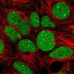 GTF2B Antibody in Immunocytochemistry (ICC/IF)