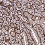 GTF2B Antibody in Immunohistochemistry (Paraffin) (IHC (P))