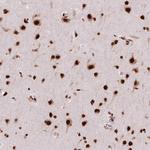 BRD4 Antibody in Immunohistochemistry (Paraffin) (IHC (P))