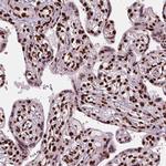 BRD4 Antibody in Immunohistochemistry (Paraffin) (IHC (P))