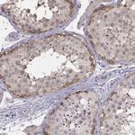 NMNAT2 Antibody in Immunohistochemistry (Paraffin) (IHC (P))