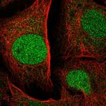 SPRED1 Antibody in Immunocytochemistry (ICC/IF)