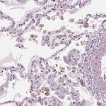 BTLA Antibody in Immunohistochemistry (Paraffin) (IHC (P))