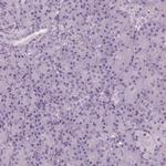 BTLA Antibody in Immunohistochemistry (Paraffin) (IHC (P))